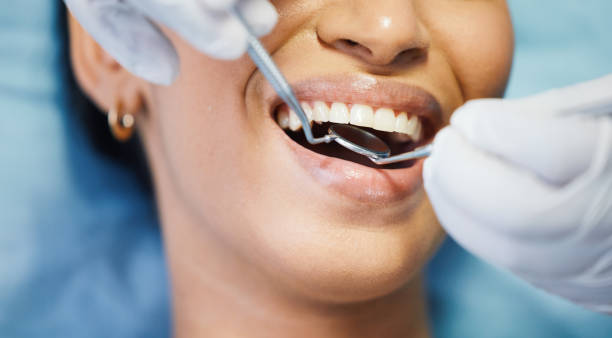 Best Broken Tooth Emergency  in Holiday City Berkeley, NJ