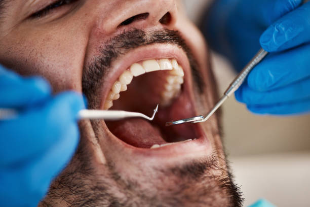 Best Root Canal Emergency Dentist  in Holiday City Berkeley, NJ